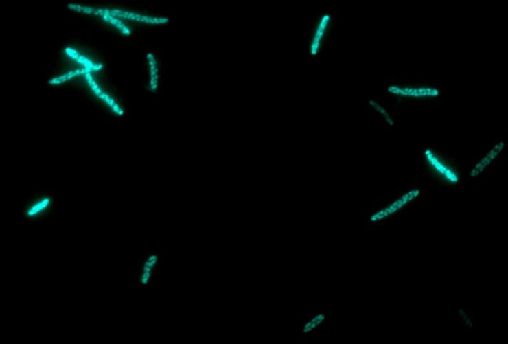 zobrazit detail snímku: Bakterie E. Coli