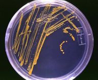 Google oslavil výročí vynálezce Petriho misky Google oslavil výročí vynálezce Petriho misky: Petriho misky zná minimálně ze školních…