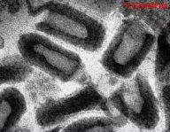 Jak je to u nás se vzteklinou? Jak je to u nás se vzteklinou?: O vzteklině bylo již napsáno opravdu hodně odborné…